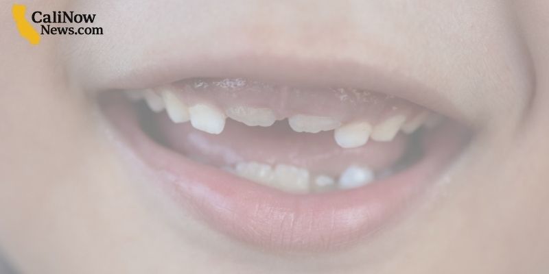 FDA Questions Fluoride Supplement Safety, Scientists Push Back